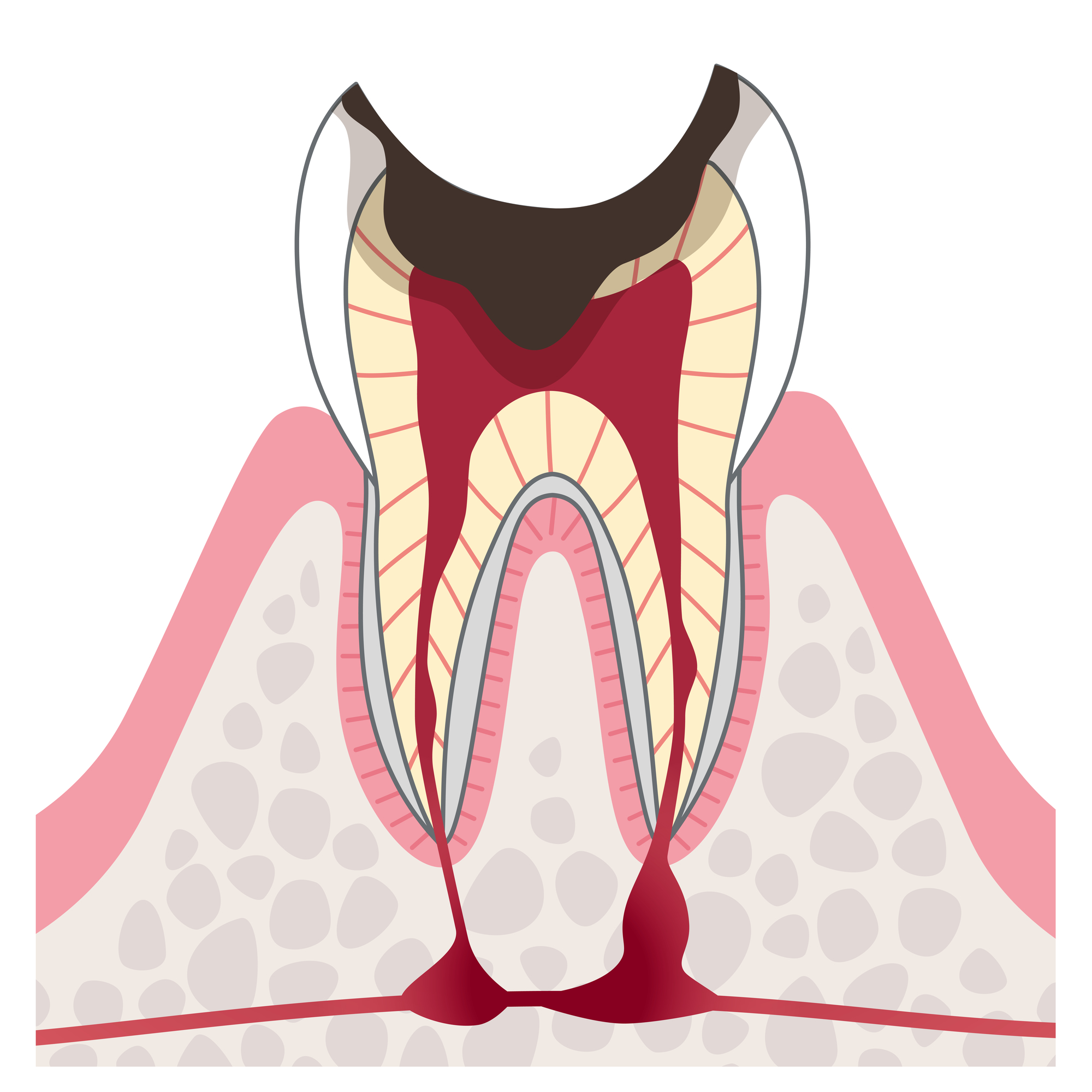 発熱で歯が痛む それは虫歯だけでなく他の病気が潜んでいる可能性が