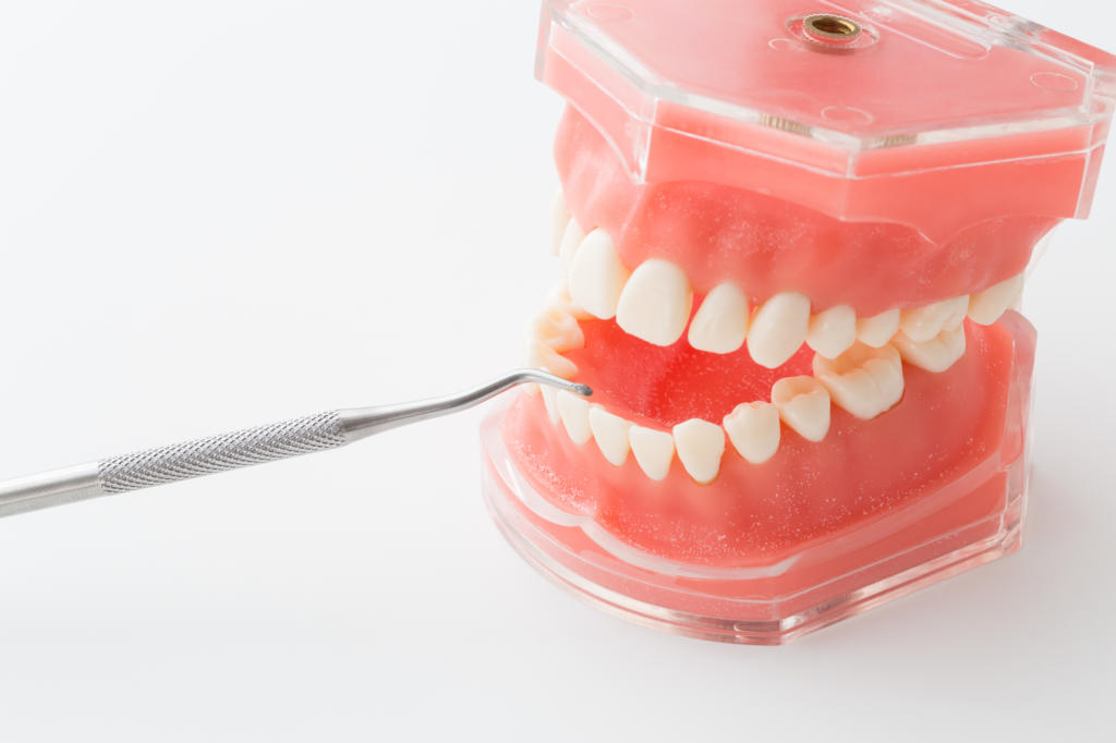入れ歯の費用や種類、性能…治療に向けて知っておきたいポイント